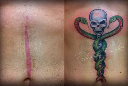 a98541_tattoo-scars_10