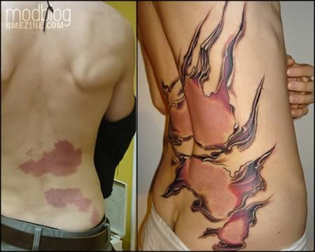 a98541_tattoo-scars_5-birthmarks