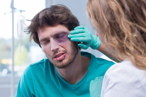 Male patient with black eye
