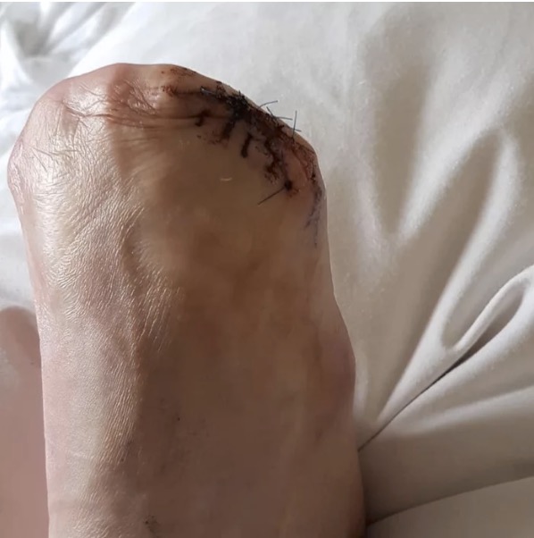 LOlkuva 2018-9-17 kello 10.20.01